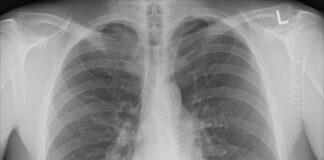 Ile kosztuje prześwietlenie stawów u psa? Ile kosztuje prześwietlenie stawów u psa?